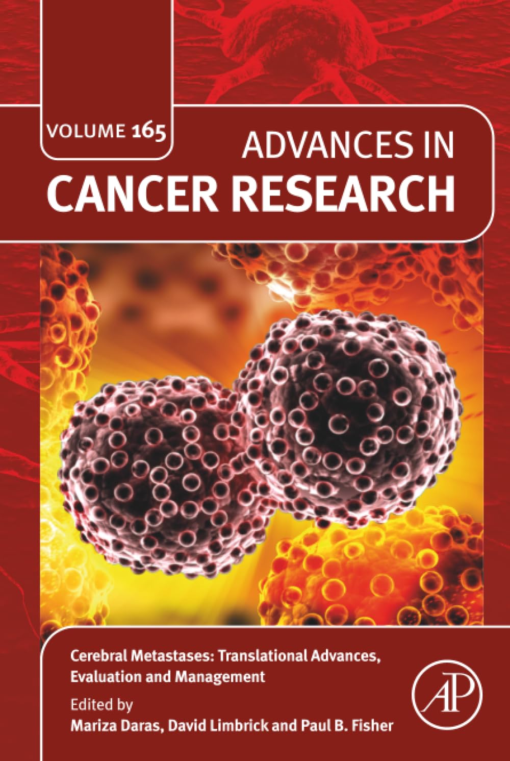 [25 June 2025] Cerebral Metastases: Translational Advances, Evaluation and Management: Volume 165 -